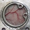 icepick method