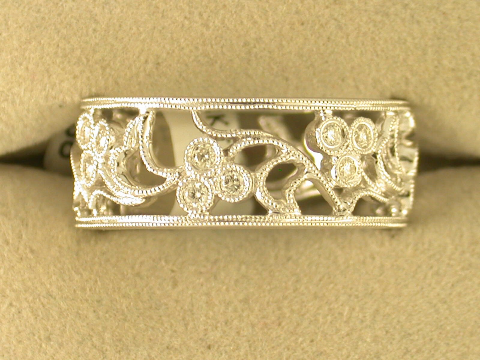 Had to have my wedding ring cut off today. — The Bump