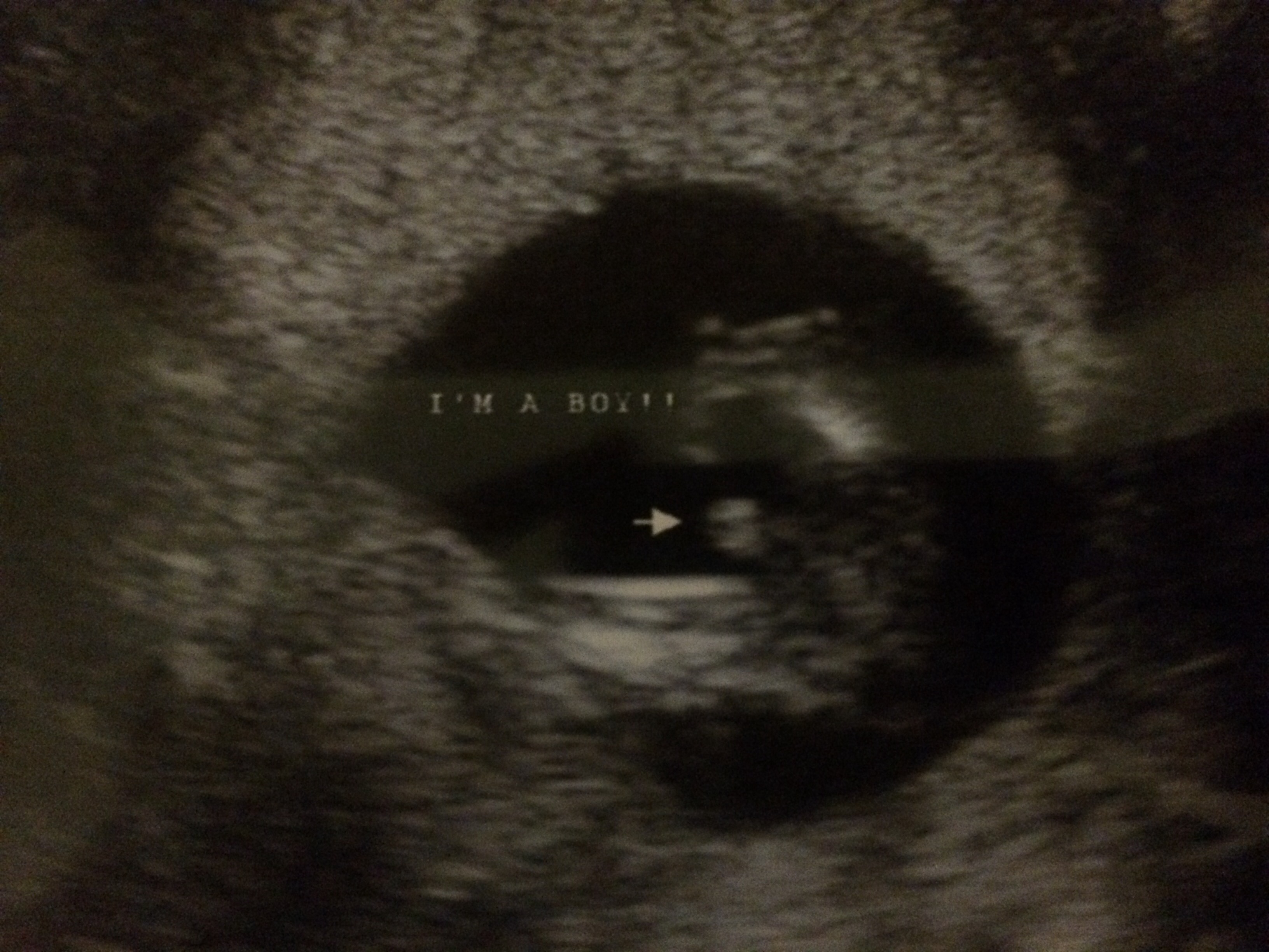 4Ab Embryo Gender:  What The Experts Say - xflgp1c