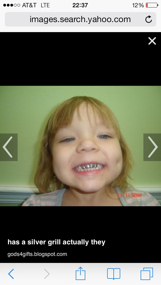 Question about kids with silver teeth — The Bump