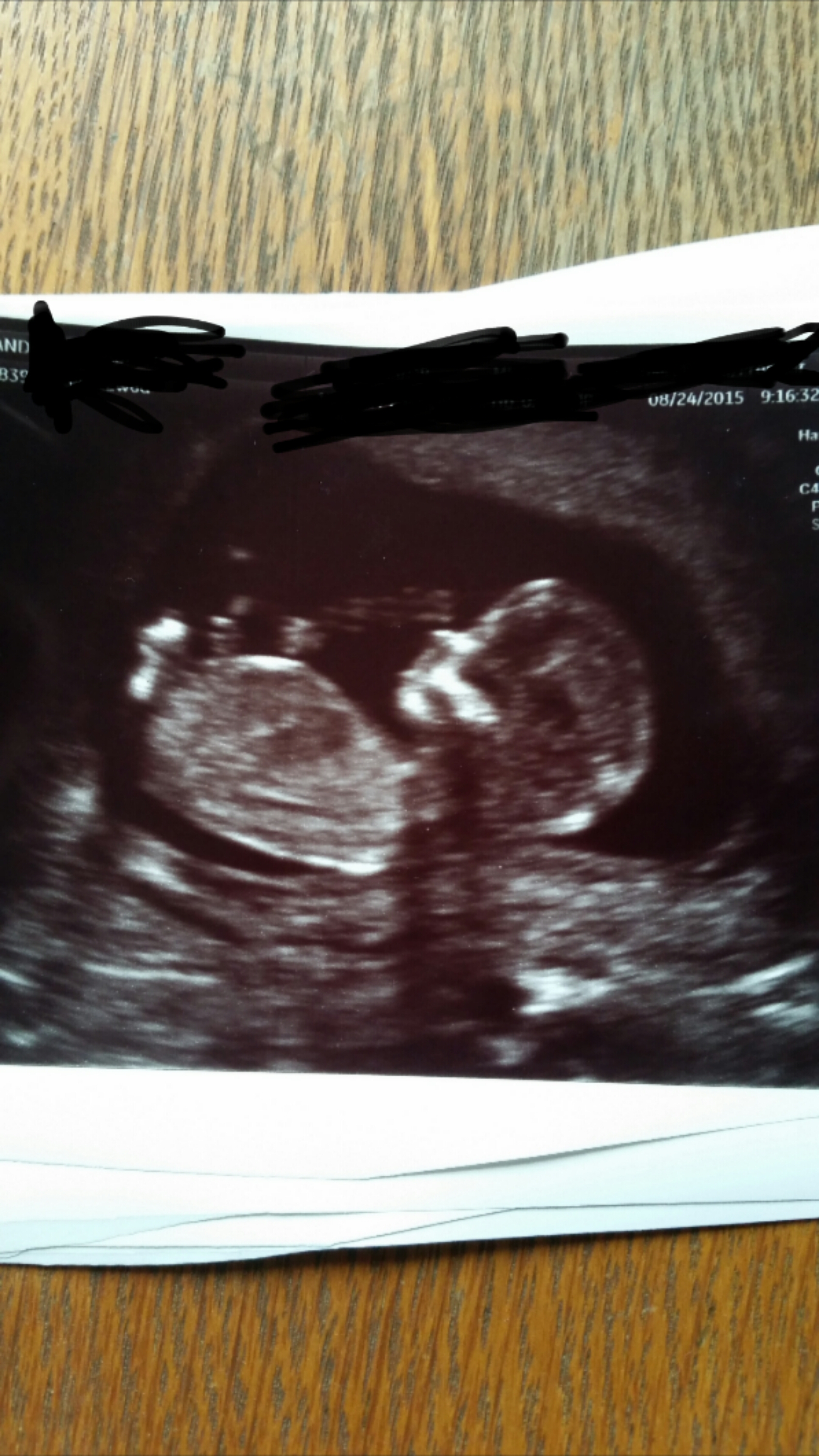 4Ab Embryo Gender:  What The Experts Say - r4sbp9q