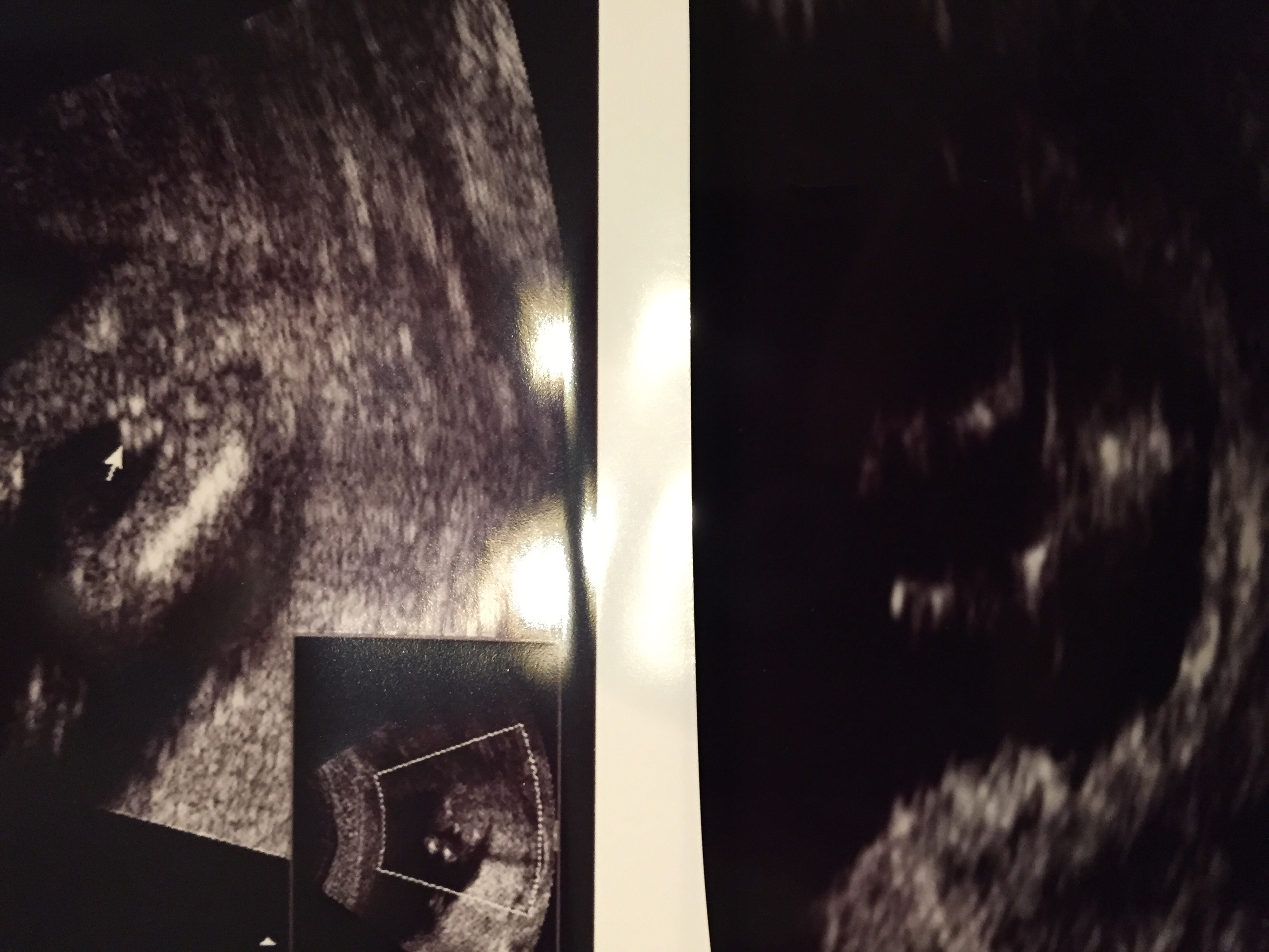 Help! Almost 14 week potty shot...can you tell the sex? — The Bump