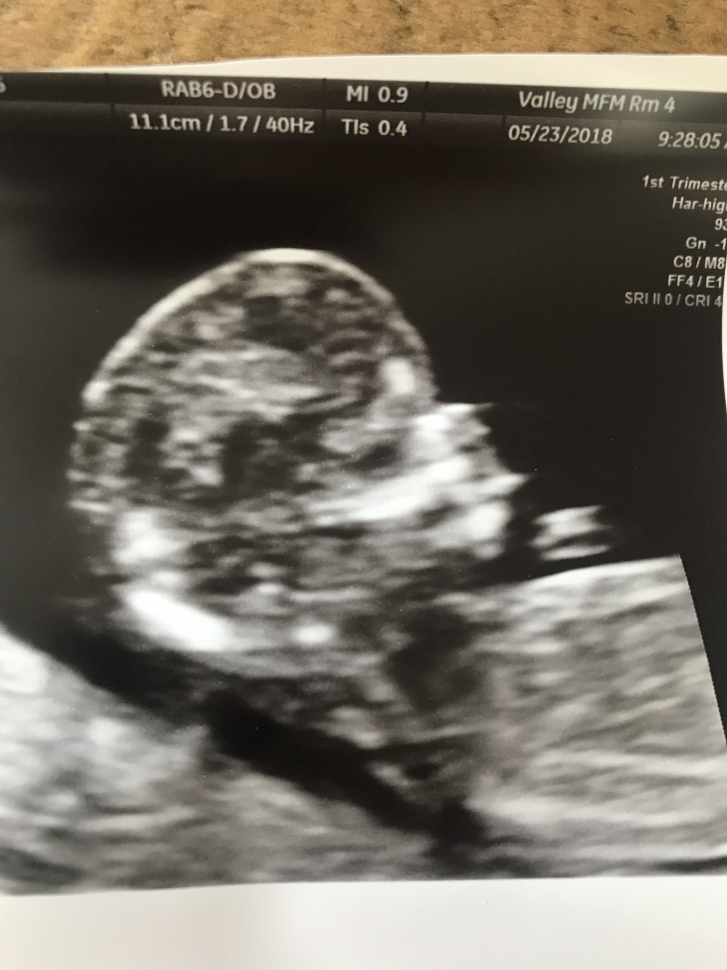 skull theory? What do you think? — The Bump