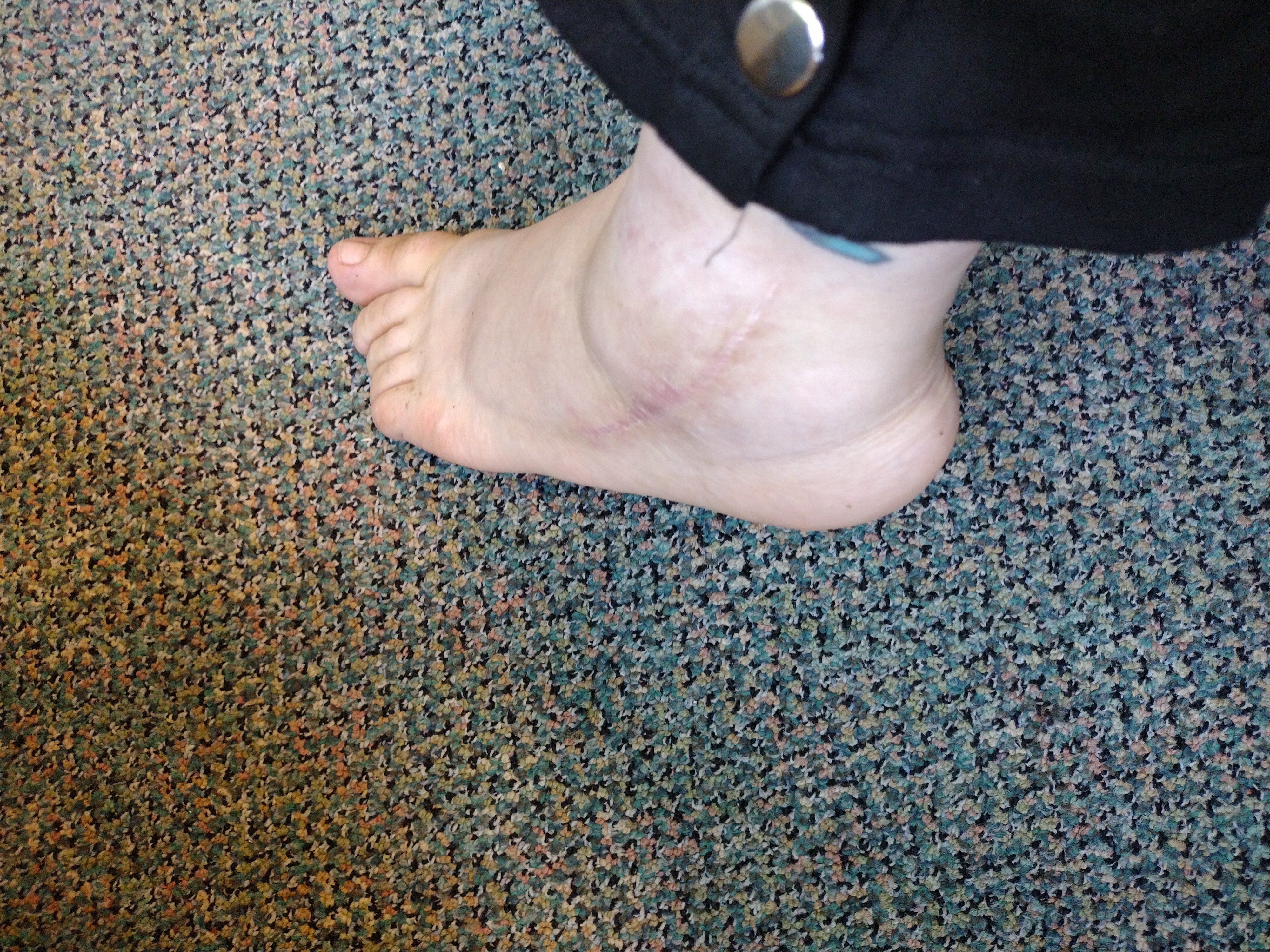 ankle.jpg