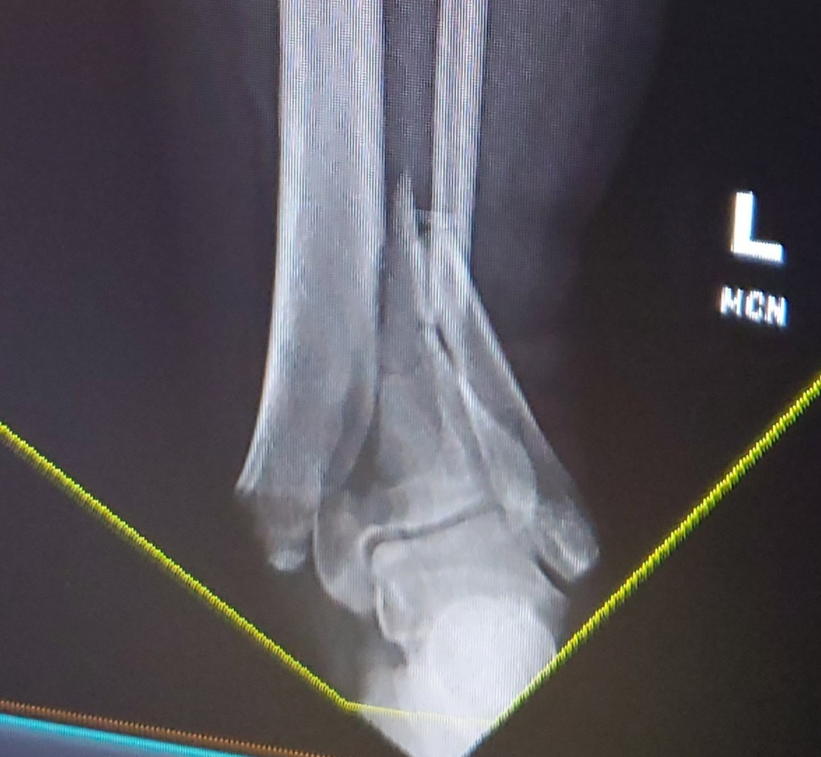 ER Pre-redux a thumb.jpg