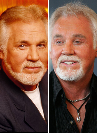 kenny-rogers-plastic-surgery.jpg