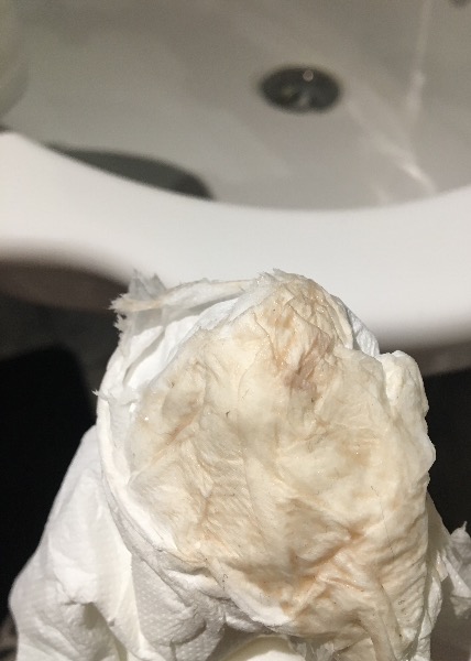 Implantation bleeding - the truth!! - Page 7 — MadeForMums Forum