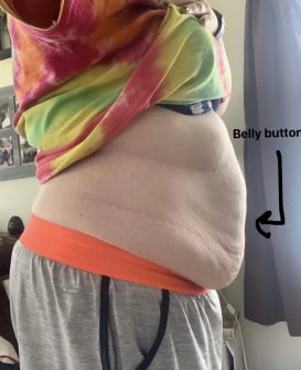 Bump showing above belly button? Anyone else look like this