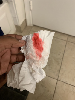 Implantation Bleeding Madeformums Forum