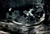 baby_vivvybug