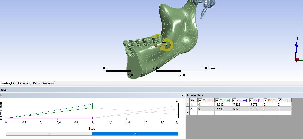 first remote displacement