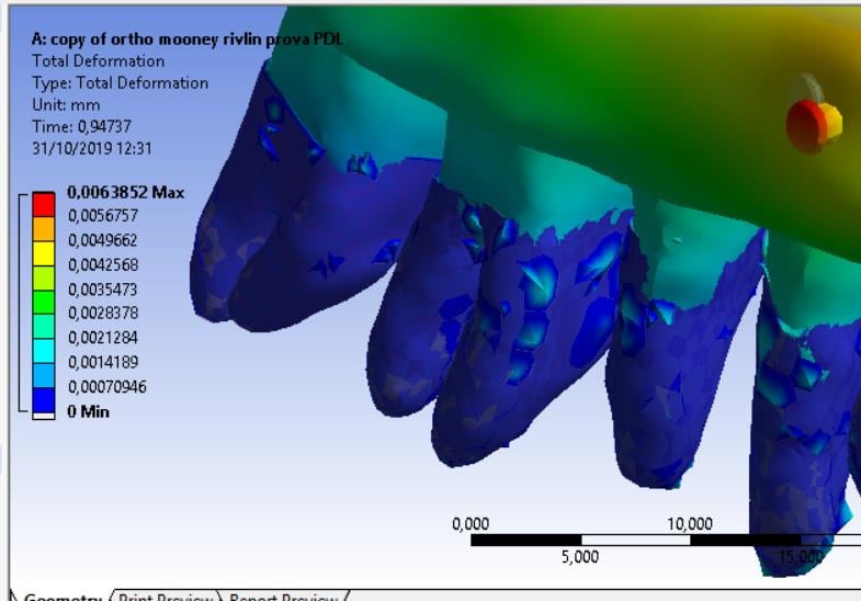 deformation of PDL