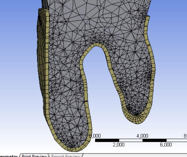 mesh of the shell with an offset to the top