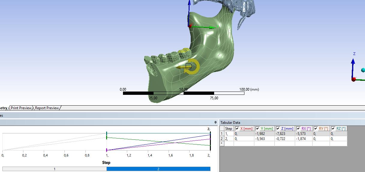 second remote displacement (B point)