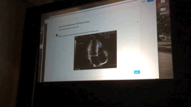 244793_IMG_0150.GIF 244793_IMG_0150.GIF