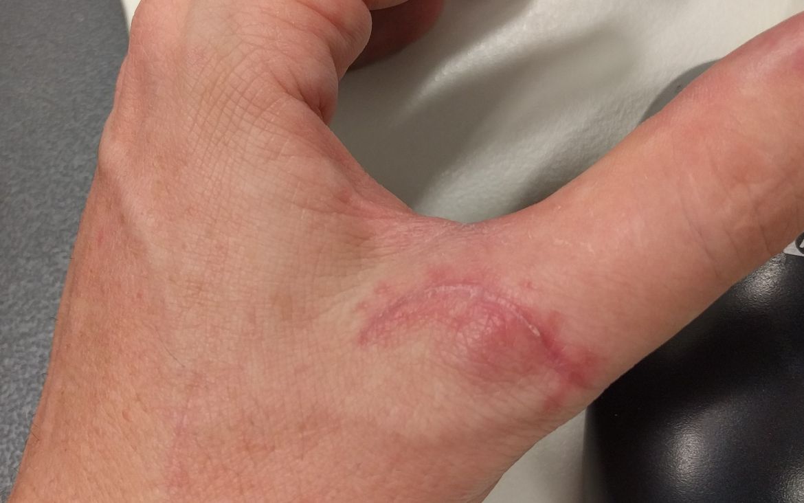 IMG_20170131_104722.jpg IMG_20170131_104722.jpg