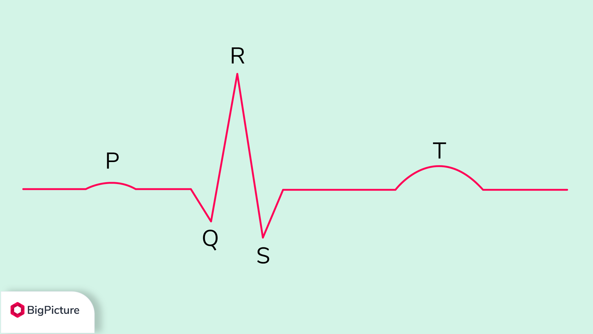 cadence-meaning-heart-cadence.png cadence-meaning-heart-cadence.png
