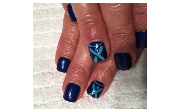 Fingernails.jpg Fingernails.jpg
