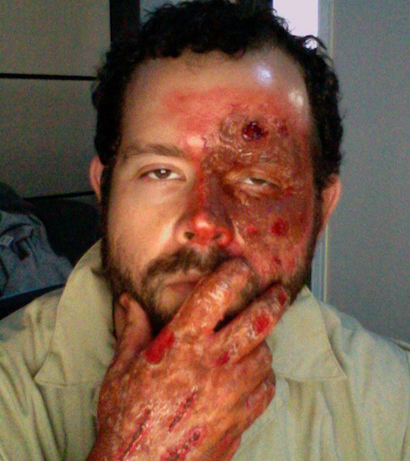 HalloweenBurns.jpg HalloweenBurns.jpg